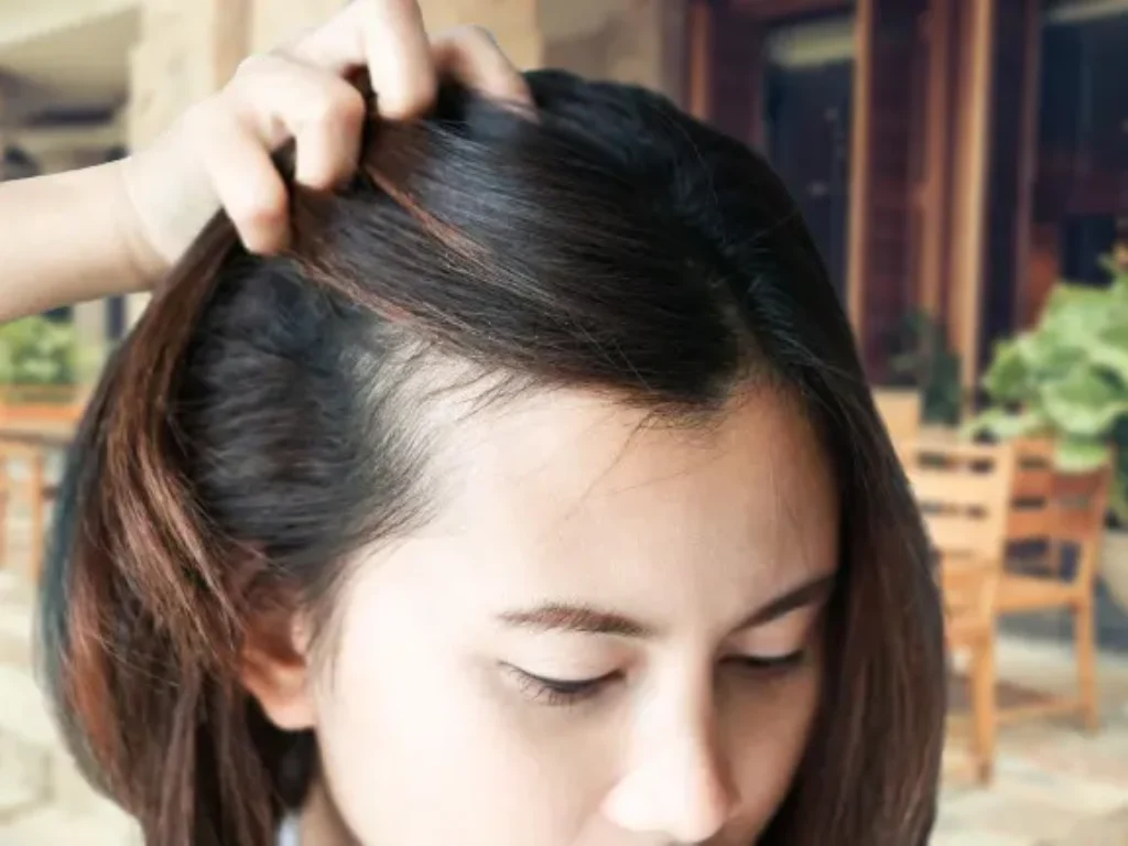 How_Often_Should_I_Oil_My_Scalp-oili_hair