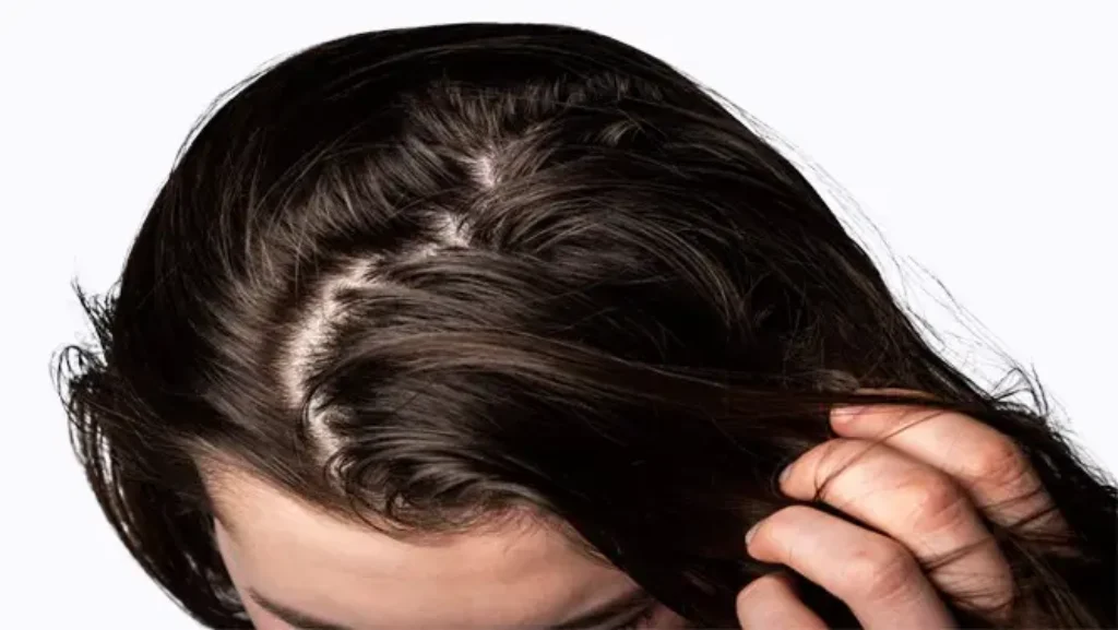 How_Often_Should_I_Oil_My_Scalp-oili_hair